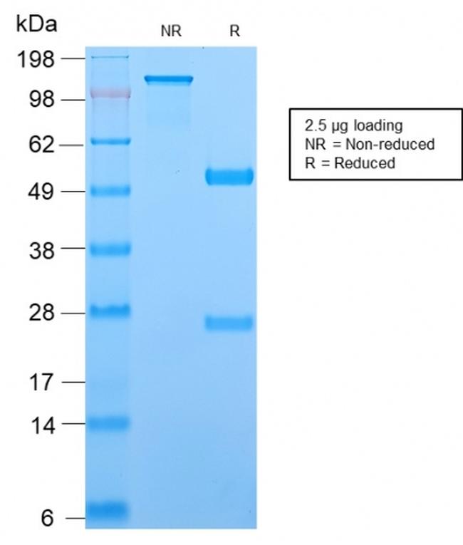 TCL1 Antibody in SDS-PAGE (SDS-PAGE)