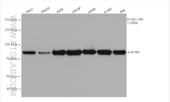 STIM1 Antibody in Western Blot (WB)