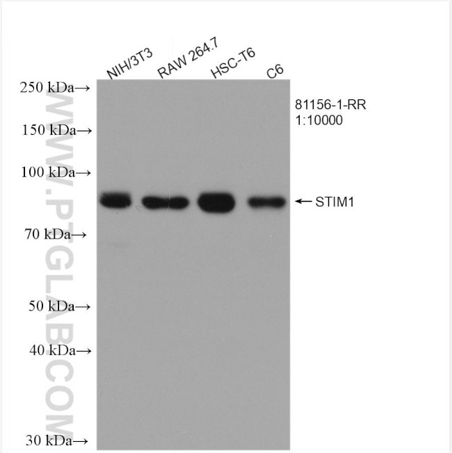 STIM1 Antibody in Western Blot (WB)