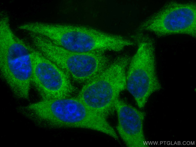 MYH9 Antibody in Immunocytochemistry (ICC/IF)