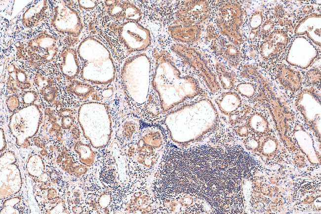 HDAC3 Antibody in Immunohistochemistry (Paraffin) (IHC (P))