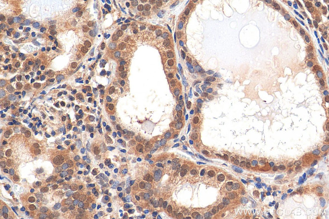 HDAC3 Antibody in Immunohistochemistry (Paraffin) (IHC (P))