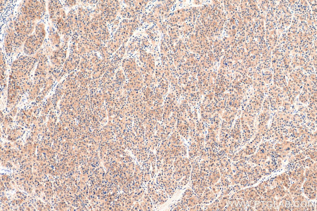 HDAC3 Antibody in Immunohistochemistry (Paraffin) (IHC (P))