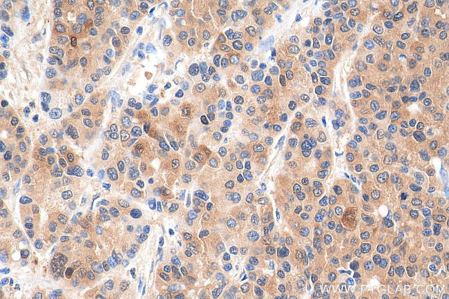 HDAC3 Antibody in Immunohistochemistry (Paraffin) (IHC (P))