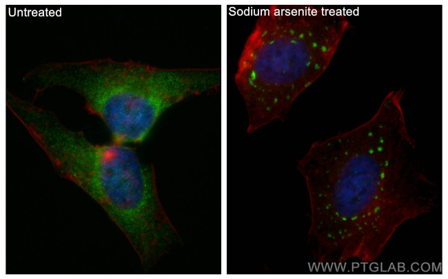 YTHDF2 Antibody in Immunocytochemistry (ICC/IF)