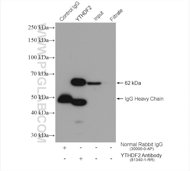 YTHDF2 Antibody in Immunoprecipitation (IP)