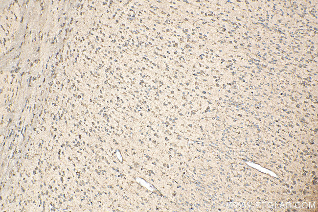 EEF1A1 Antibody in Immunohistochemistry (Paraffin) (IHC (P))