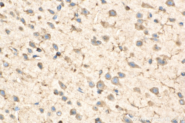 EEF1A1 Antibody in Immunohistochemistry (Paraffin) (IHC (P))