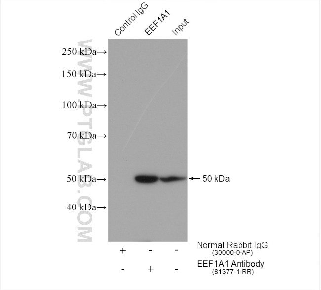 EEF1A1 Antibody in Immunoprecipitation (IP)