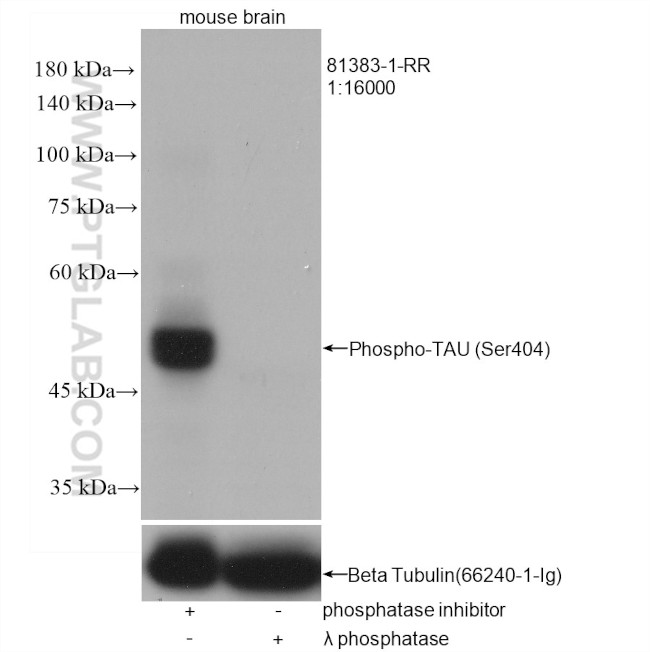 Phospho-TAU (Ser404) Antibody in Western Blot (WB)