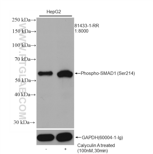 Phospho-SMAD1 (Ser214) Antibody in Western Blot (WB)