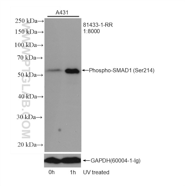 Phospho-SMAD1 (Ser214) Antibody in Western Blot (WB)