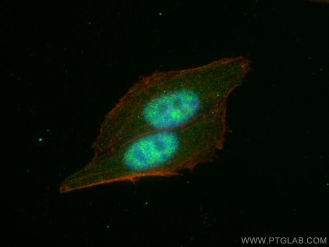 FTO Antibody in Immunocytochemistry (ICC/IF)