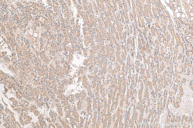 FTO Antibody in Immunohistochemistry (Paraffin) (IHC (P))