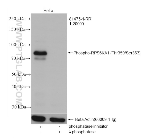 Phospho-RPS6KA1 (Thr359, Ser363) Antibody in Western Blot (WB)