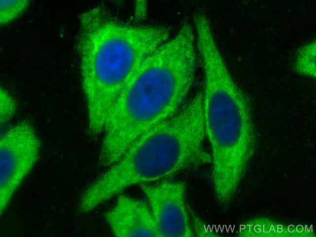 ENO1 Antibody in Immunocytochemistry (ICC/IF)