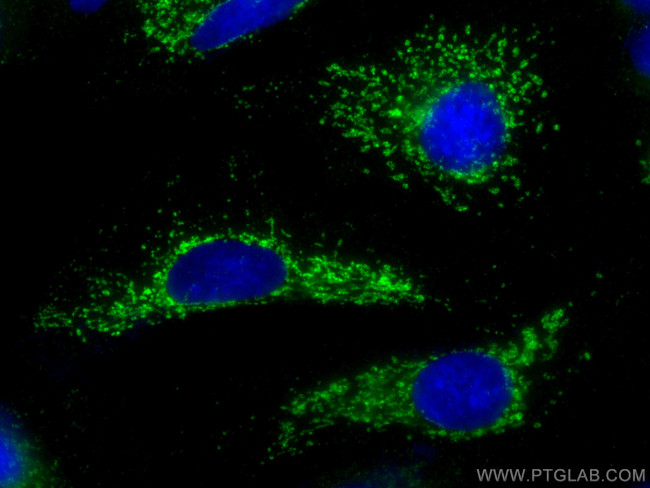 GLS Antibody in Immunocytochemistry (ICC/IF)