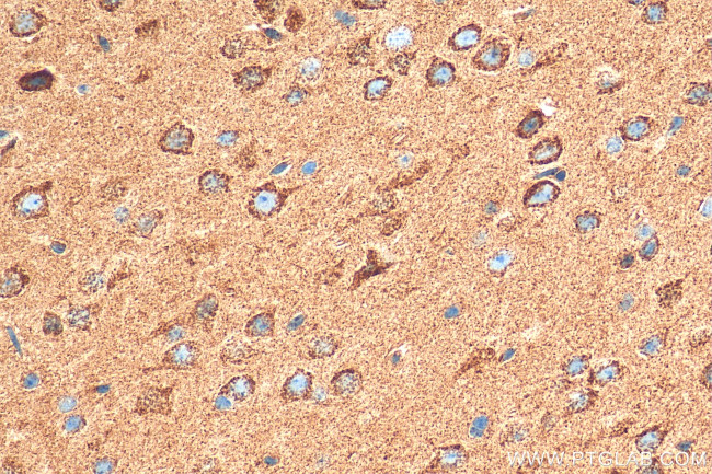 GLS Antibody in Immunohistochemistry (Paraffin) (IHC (P))