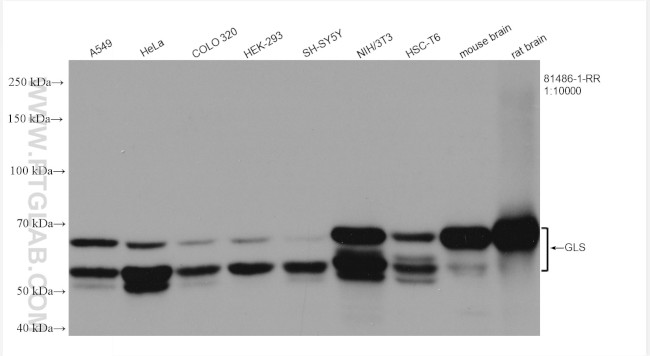 GLS Antibody in Western Blot (WB)