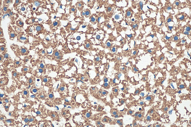 VDAC1/Porin Antibody in Immunohistochemistry (Paraffin) (IHC (P))