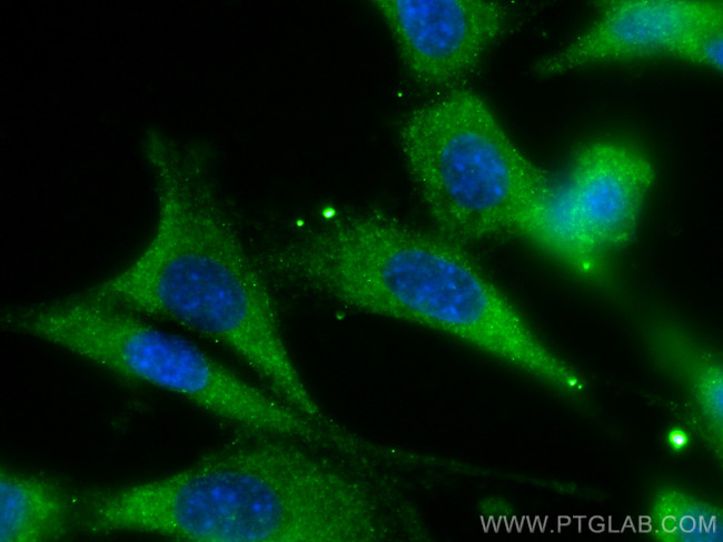 DRP1 Antibody in Immunocytochemistry (ICC/IF)