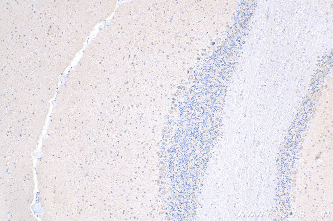 DRP1 Antibody in Immunohistochemistry (Paraffin) (IHC (P))