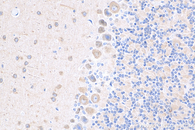 DRP1 Antibody in Immunohistochemistry (Paraffin) (IHC (P))