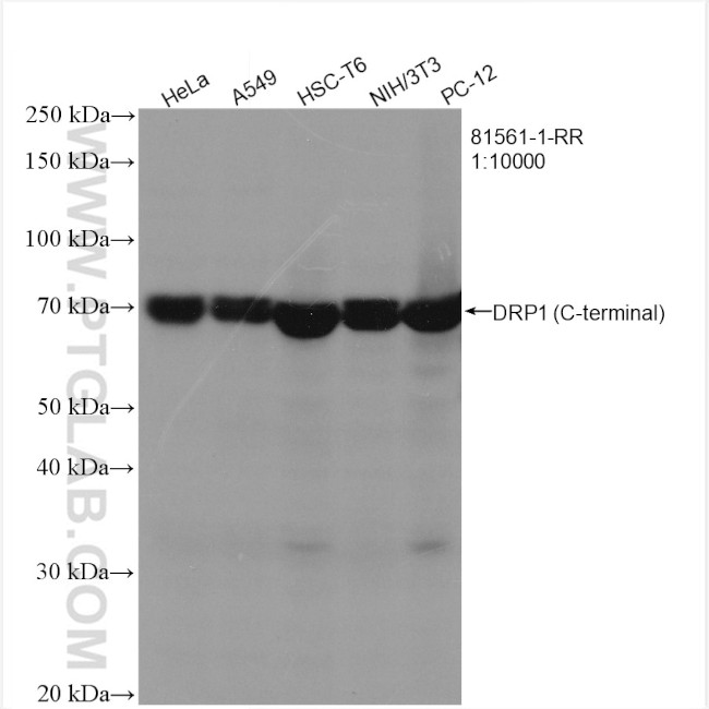 DRP1 Antibody in Western Blot (WB)