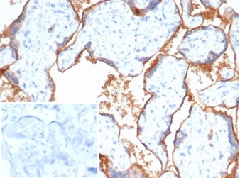 Nectin 4/Nectin Cell Adhesion Molecule 4/PVRL4 Antibody in Immunohistochemistry (Paraffin) (IHC (P))