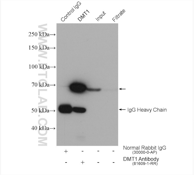 DMT1 Antibody in Immunoprecipitation (IP)