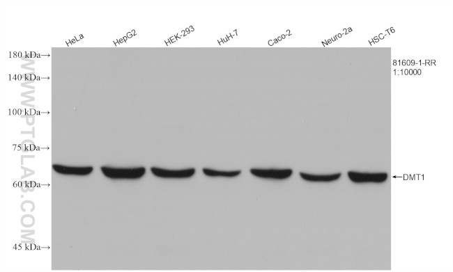 DMT1 Antibody in Western Blot (WB)