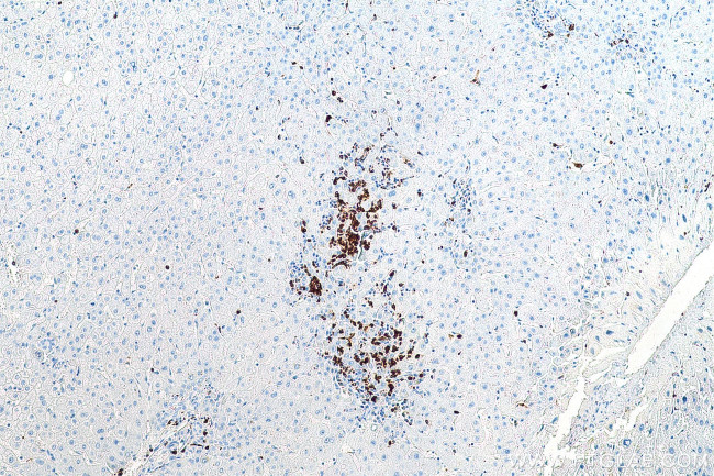 MPO Antibody in Immunohistochemistry (Paraffin) (IHC (P))