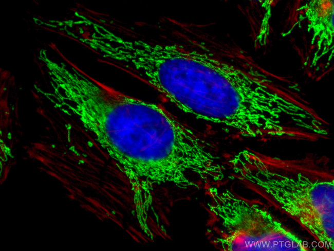 ECHS1 Antibody in Immunocytochemistry (ICC/IF)