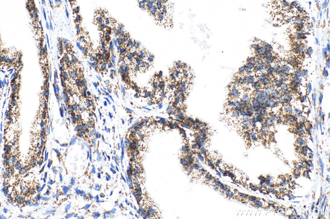 ECHS1 Antibody in Immunohistochemistry (Paraffin) (IHC (P))