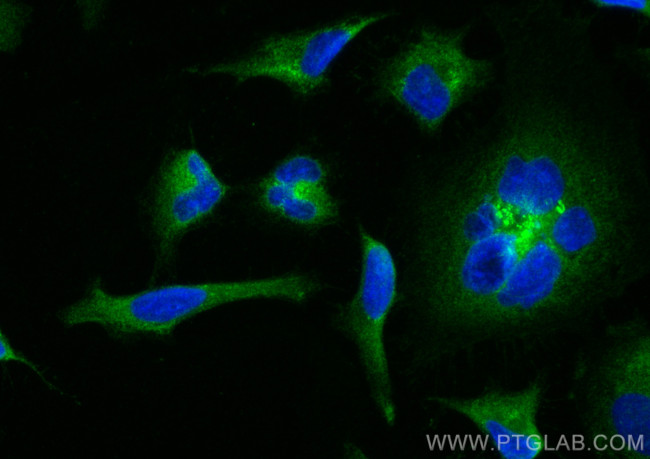 pan-RAS Antibody in Immunocytochemistry (ICC/IF)