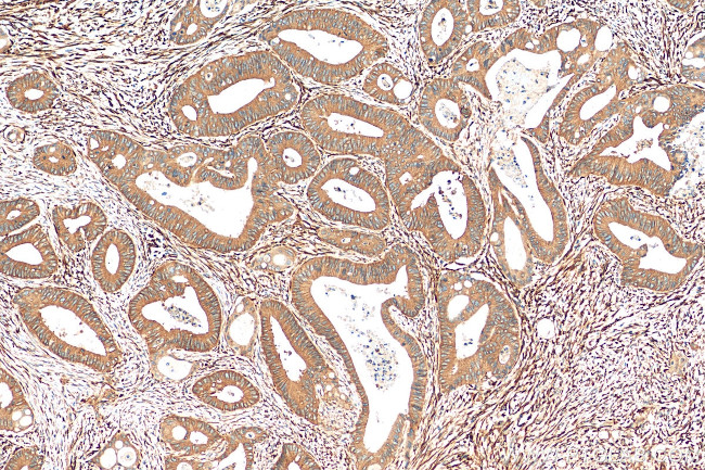 pan-RAS Antibody in Immunohistochemistry (Paraffin) (IHC (P))