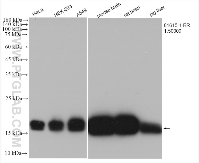 pan-RAS Antibody in Western Blot (WB)