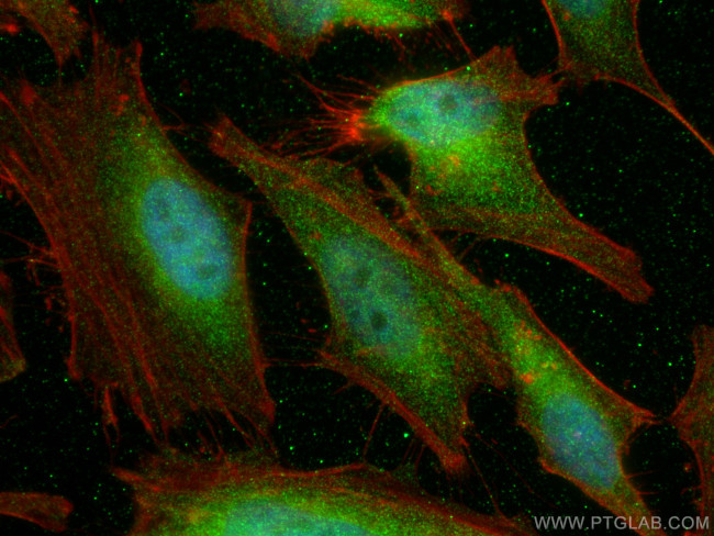 JNK Antibody in Immunocytochemistry (ICC/IF)