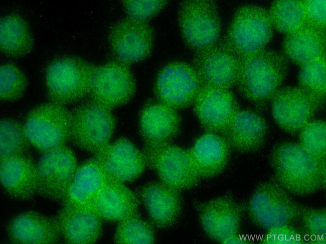 JNK Antibody in Immunocytochemistry (ICC/IF)