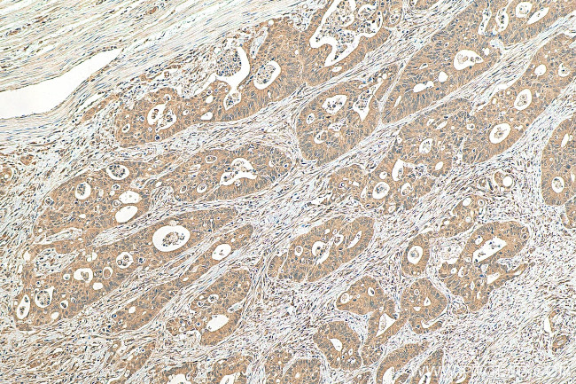 JNK Antibody in Immunohistochemistry (Paraffin) (IHC (P))