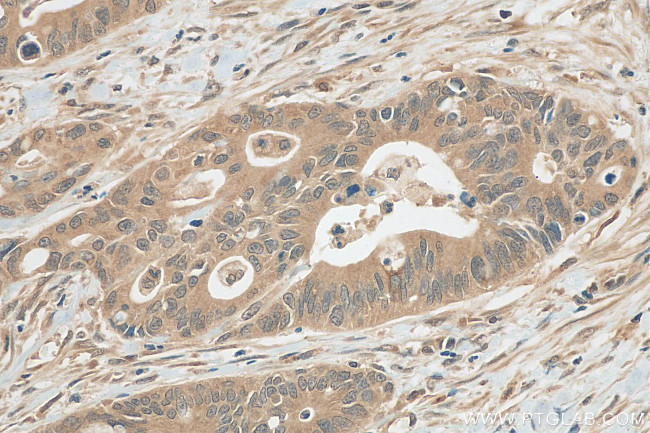 JNK Antibody in Immunohistochemistry (Paraffin) (IHC (P))