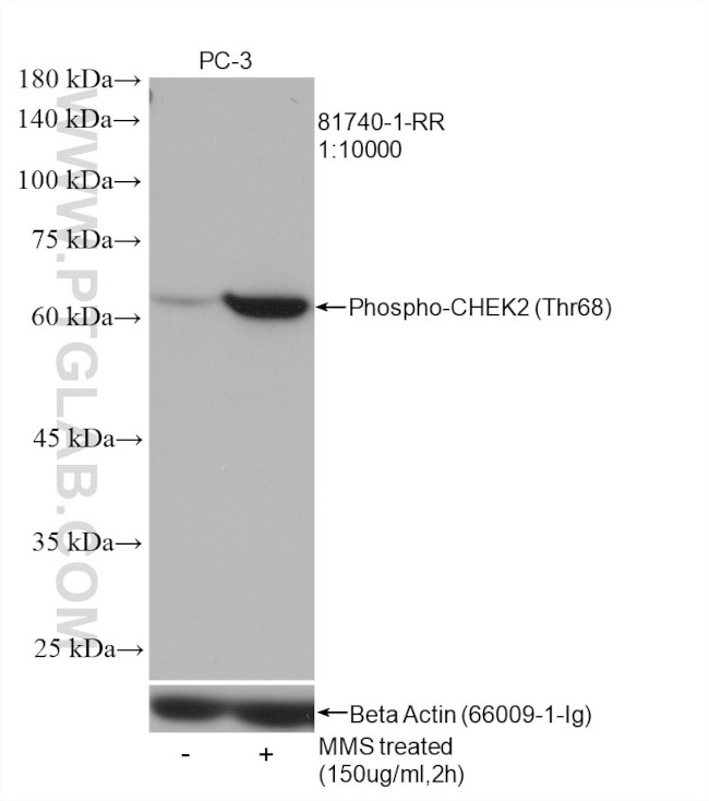 Phospho-CHEK2 (Thr68) Antibody in Western Blot (WB)