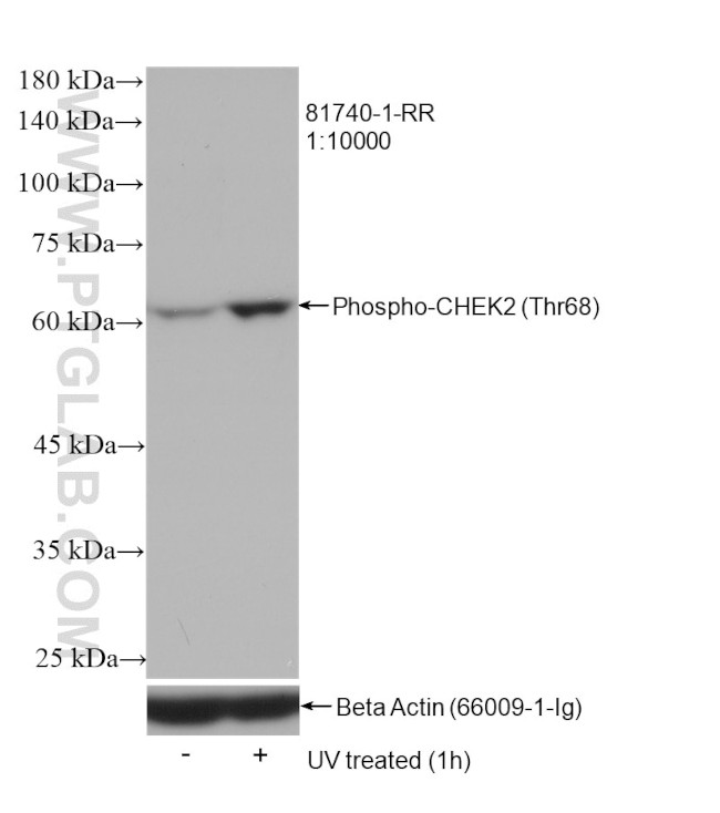 Phospho-CHEK2 (Thr68) Antibody in Western Blot (WB)