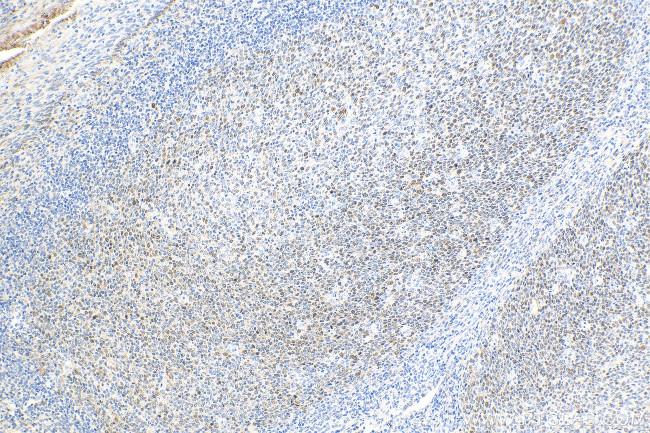 BCL6 Antibody in Immunohistochemistry (Paraffin) (IHC (P))