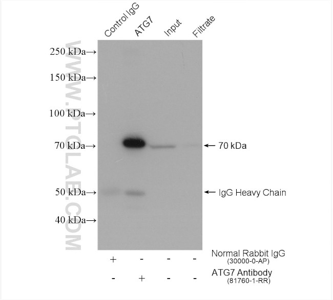 ATG7 Antibody in Immunoprecipitation (IP)