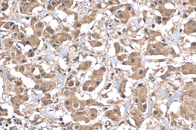 ATF4 Antibody in Immunohistochemistry (Paraffin) (IHC (P))