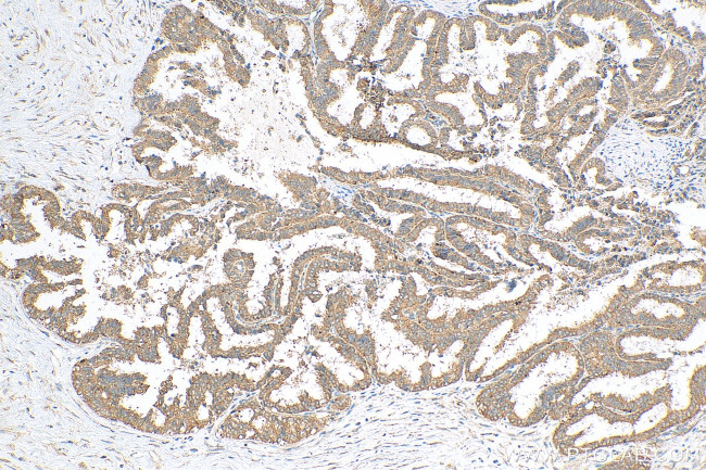 ATG5 Antibody in Immunohistochemistry (Paraffin) (IHC (P))