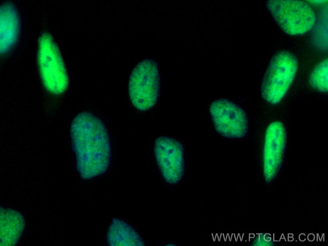 Androgen Receptor Antibody in Immunocytochemistry (ICC/IF)