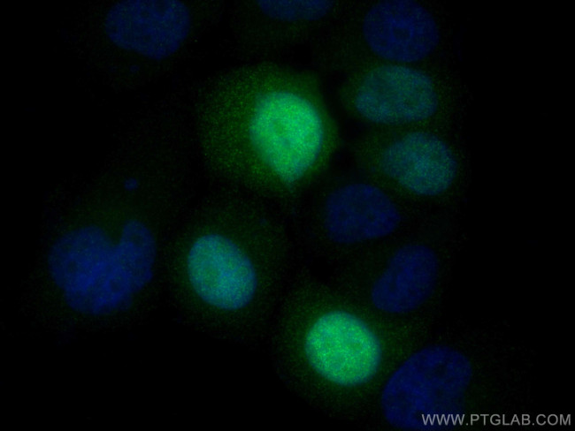 UBE2S Antibody in Immunocytochemistry (ICC/IF)