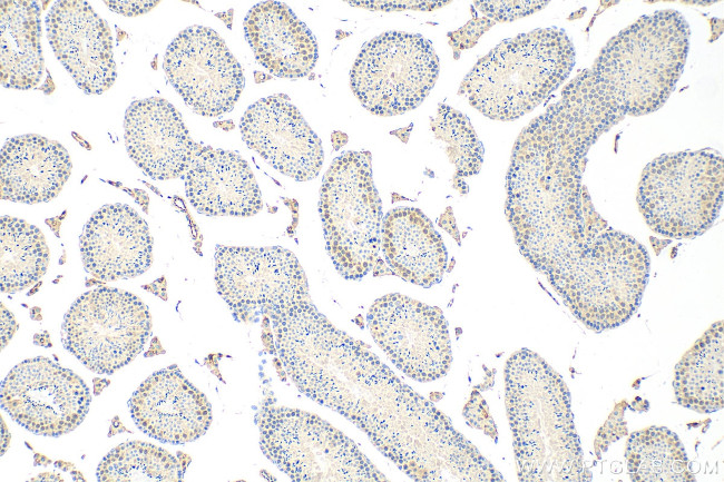 UBE2S Antibody in Immunohistochemistry (Paraffin) (IHC (P))